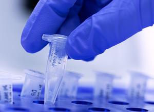 PCR-Nachweis im Labor PCR-Nachweis im Labor